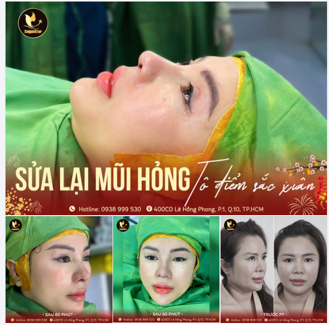 SỬA LẠI MŨI HỎNG - TÔ ĐIỂM SẮC XUÂN