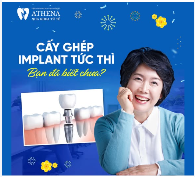 Cấy ghép Implant tức thì đang trở thành lựa chọn hàng đầu trong nha khoa hiện đại nhờ sự tiện lợi và hiệu quả vượt trội.