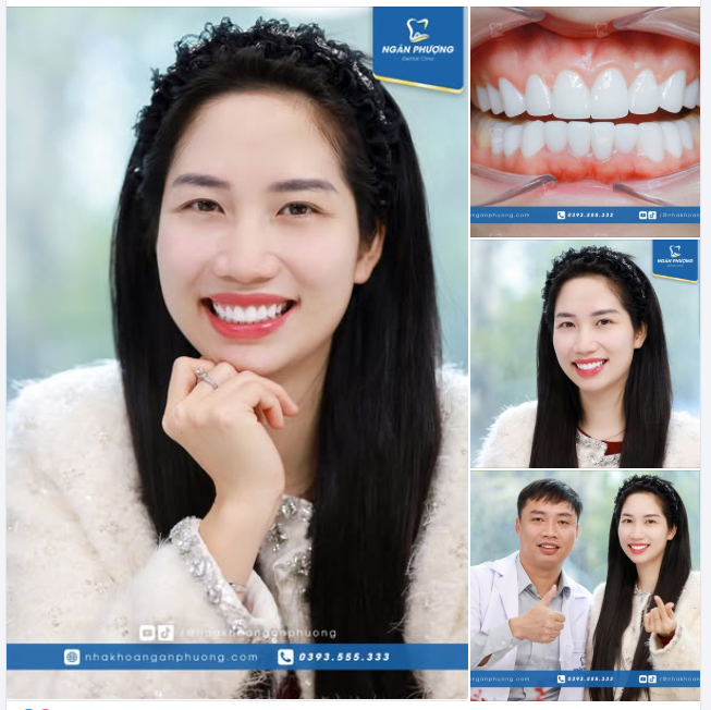 Tái khám sau 2 năm, nụ cười của chị Trà My khiến bác sĩ nào cũng phải trầm trồ