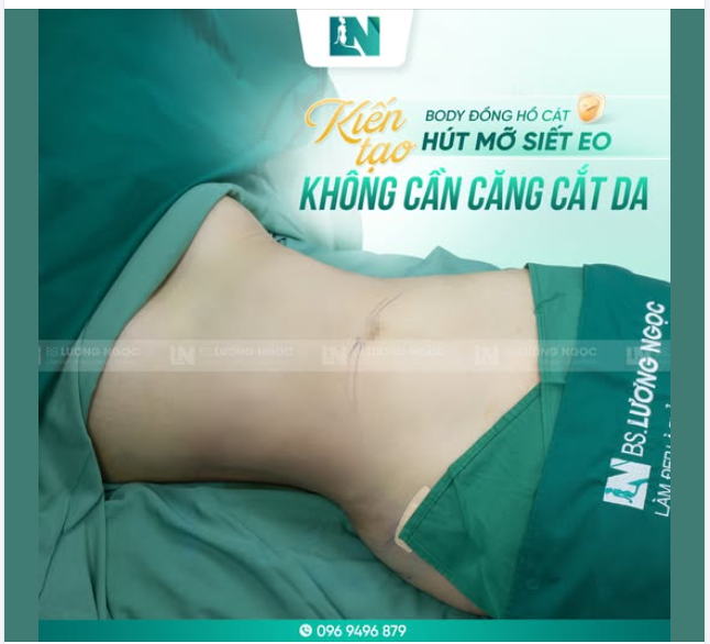 Chiếc eo “đồng hồ cát” này là thành quả “hút mỡ siết eo không cần căng cắt” của nhà Bác sĩ Lương Ngọc.