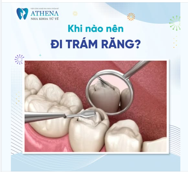 Trám răng không chỉ giúp khôi phục hình dáng và chức năng của răng mà còn ngăn ngừa các vấn đề nghiêm trọng hơn về răng miệng. Vậy khi nào bạn nên đi trám răng?