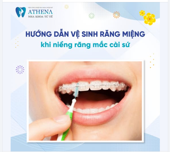 Niềng răng mắc cài sứ không chỉ mang lại nụ cười đẹp mà còn giúp khắc phục các vấn đề về khớp cắn.