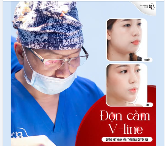 ĐỘN CẰM VLINE kiến tạo VẺ ĐẸP THANH TÚ