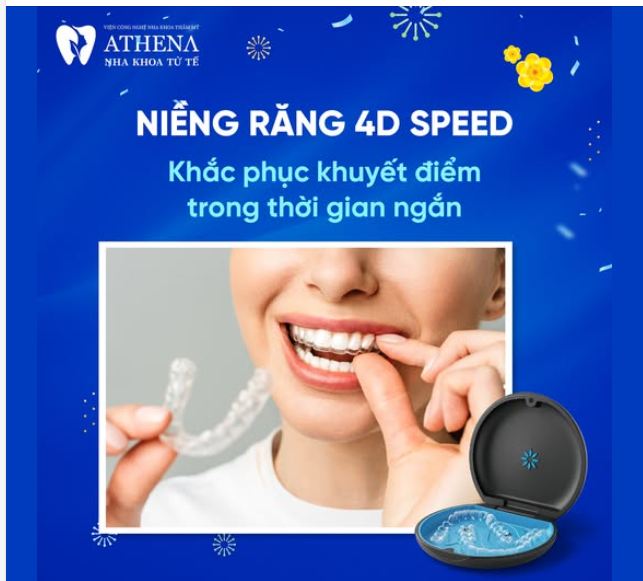 TẠI SAO NIỀNG RĂNG 4D SPEED LÀ SỰ LỰA CHỌN TỐT NHẤT?