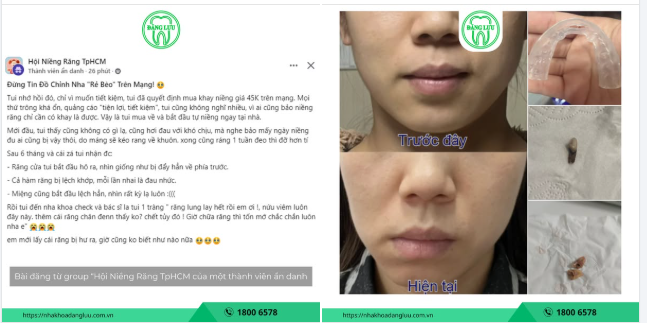 TỈNH TÁO TRƯỚC NHỮNG LỜI QUẢNG CÁO CHỈNH NHA "RẺ BÈO" TRÊN MẠNG!