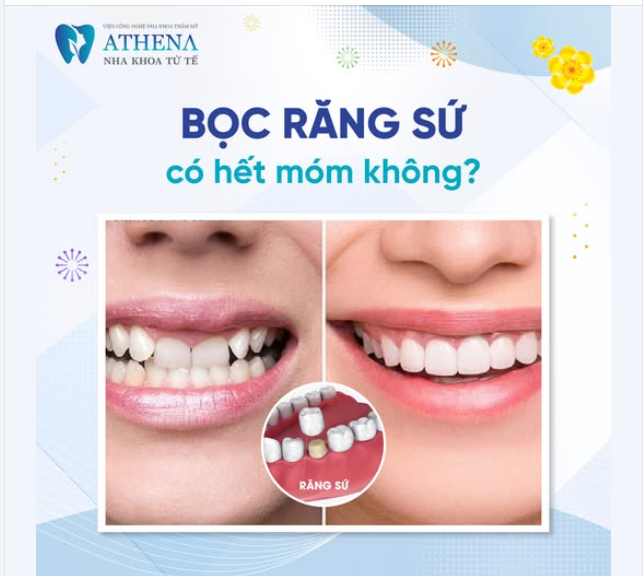 Bọc răng sứ là giải pháp thẩm mỹ hiện đại và hiệu quả trong việc cải thiện các vấn đề về hình dáng và màu sắc răng.