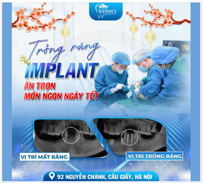 CẤY GHÉP IMPLANT - ĂN TRỌN MÓN NGON NGÀY TẾT