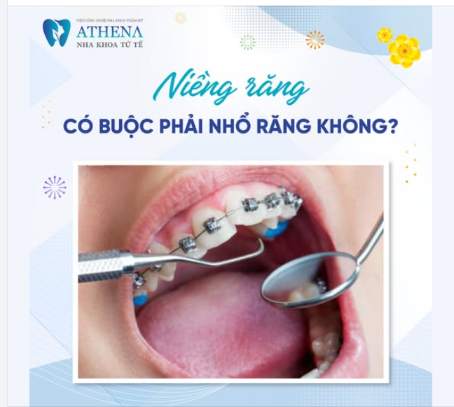 Câu trả lời là không phải ai cũng cần nhổ răng. Việc này phụ thuộc vào tình trạng răng miệng và kế hoạch điều trị cụ thể.