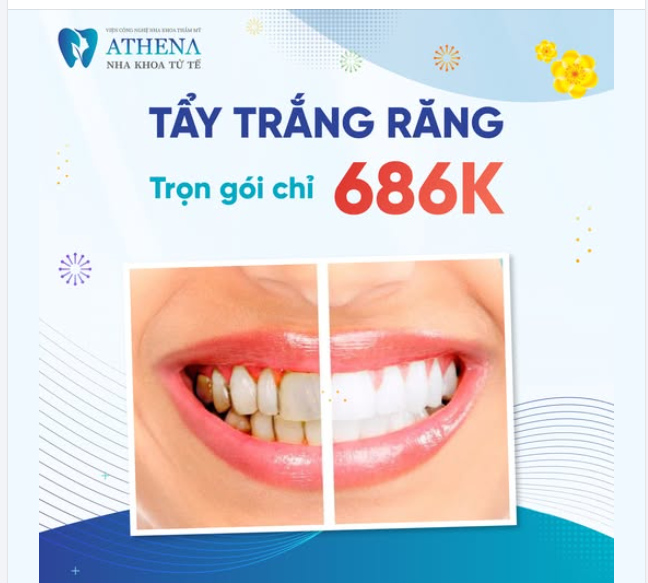 Bạn đang tự ti vì hàm răng xỉn màu, ố vàng? Hãy để Nha Khoa ATHENA mang đến cho bạn một nụ cười rạng rỡ đón Tết với ưu đãi siêu HOT: Tẩy trắng răng Plasma trọn gói chỉ 686K!