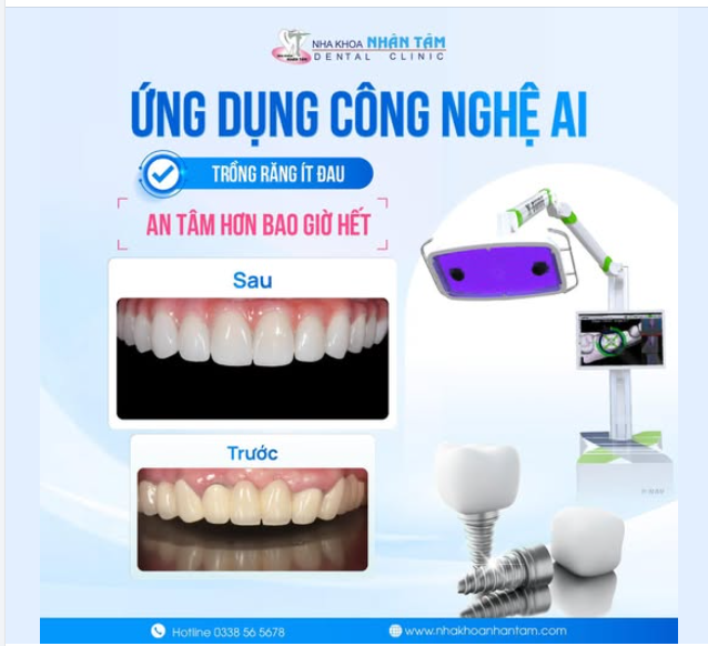 Trồng răng với công nghệ AI tại Nhân Tâm: An tâm hơn bao giờ hết!