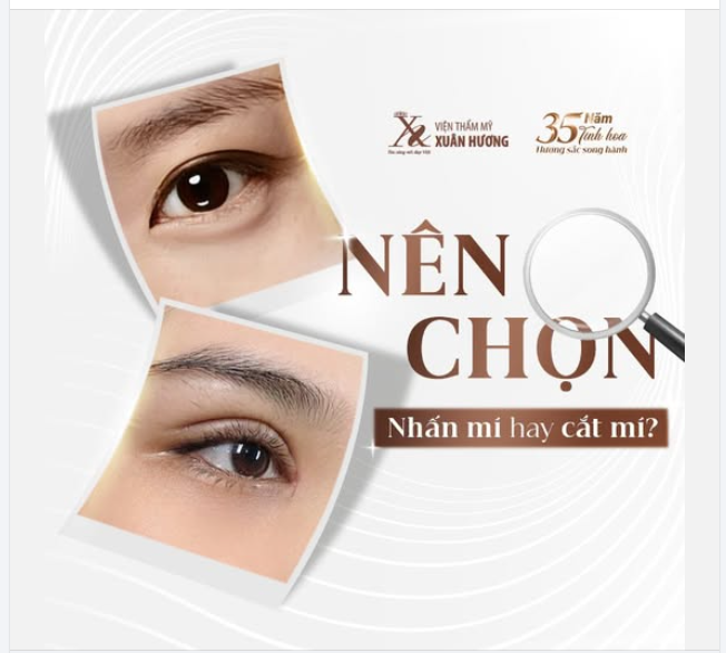 NÊN CHỌN NHẤN MÍ HAY CẮT MÍ