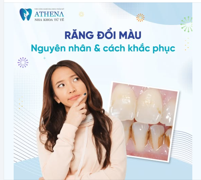  Nguyên nhân khiến răng đổi màu
