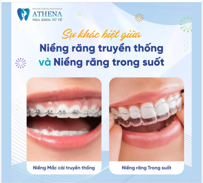 Việc lựa chọn phương pháp niềng răng phù hợp không chỉ dựa trên hiệu quả mà còn liên quan đến thẩm mỹ, sự thoải mái, và chi phí. Dưới đây là sự khác biệt giữa hai phương pháp phổ biến:
