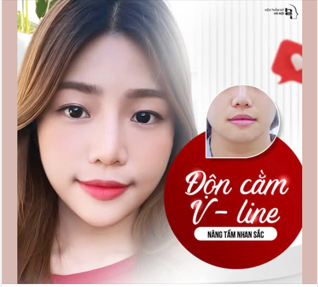ĐỘN CẰM VLINE  Mặt thon gọn - nâng tầm nhan sắc