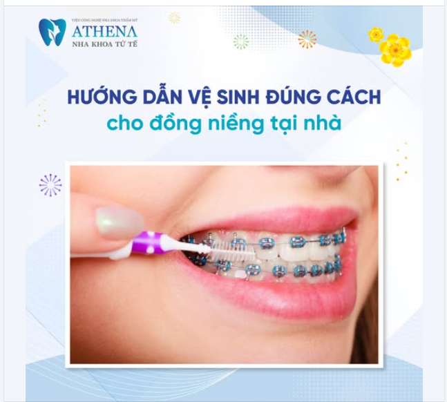 Việc vệ sinh răng miệng đúng cách khi niềng răng đóng vai trò quan trọng, giúp bảo vệ sức khỏe răng miệng và đảm bảo hiệu quả chỉnh nha. Dưới đây là các bước cần thiết: