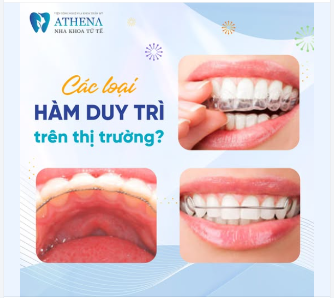 Sau khi kết thúc quá trình niềng răng, hàm duy trì là giải pháp cần thiết để giữ cho răng cố định tại vị trí mới và ngăn ngừa tình trạng răng dịch chuyển trở lại.