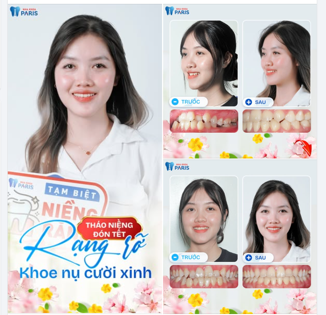 CHÚC MỪNG KH. MINH HIỀN THÁO NIỀNG THÀNH CÔNG