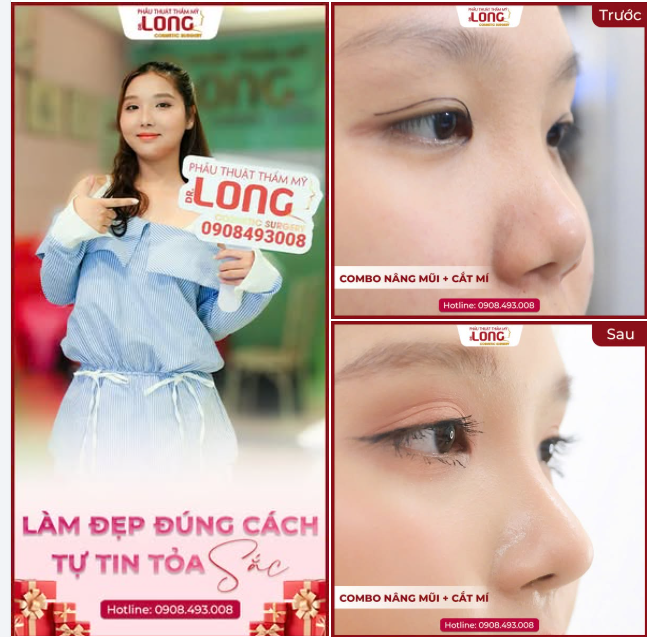 MŨI MẮT ĐẸP XINH TỰ TIN ĐÓN TẾT