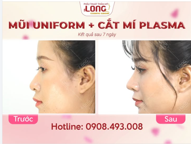 Mỗi đôi mắt, dáng mũi là một sự THAY ĐỔI đáng tự hào