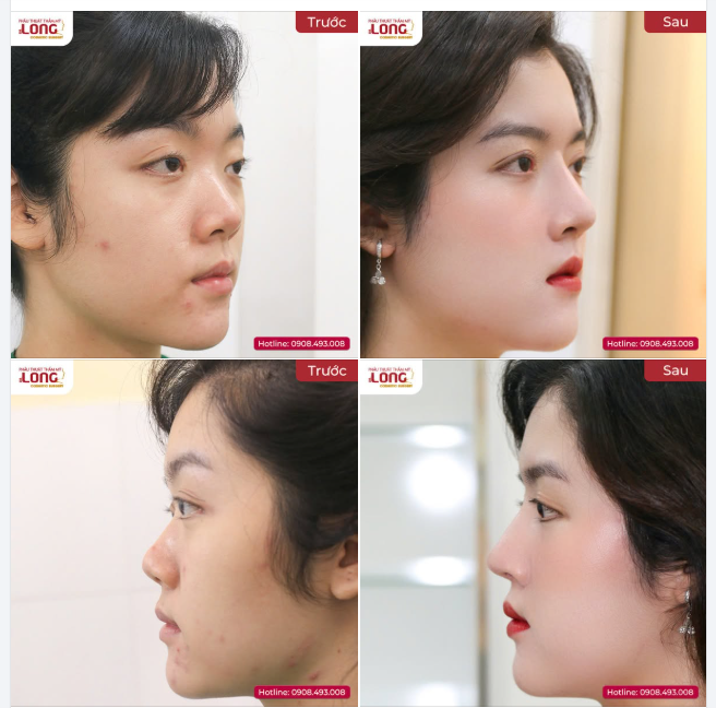 NÀNG KIỀU LỠ BƯỚC KHIẾN BẢN THÂN SAI LẦM VỚI QUYẾT ĐỊNH NÀY