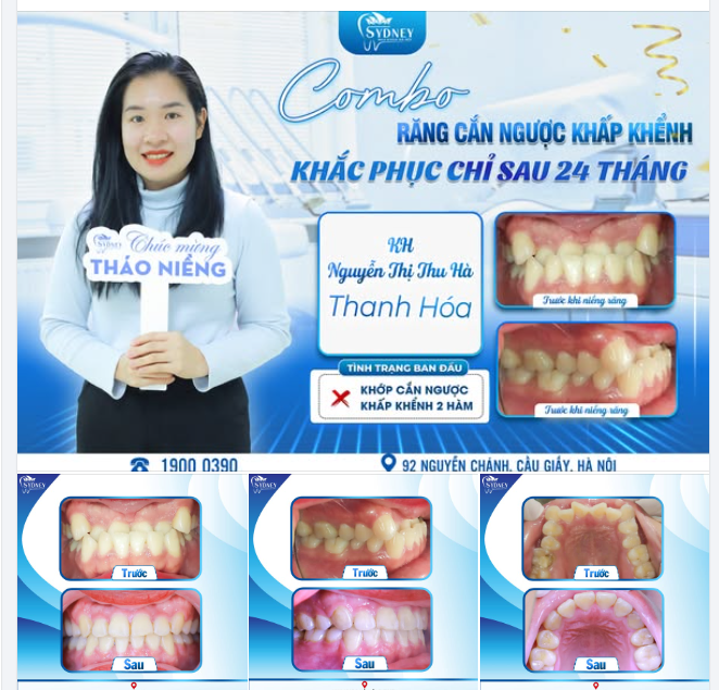 COMBO CẮN NGƯỢC - KHẤP KHỂNH: KHẮC PHỤC CHỈ SAU 24 THÁNG