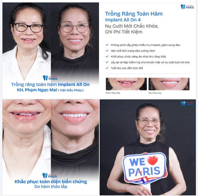 Giá trị mà nụ cười mới mang tới không chỉ là sự cuốn hút và thần thái đầy ấn tượng mà còn tín hiệu khởi sắc cho 1 cuộc sống tràn ngập niềm vui và hạnh phúc ở phía trước.