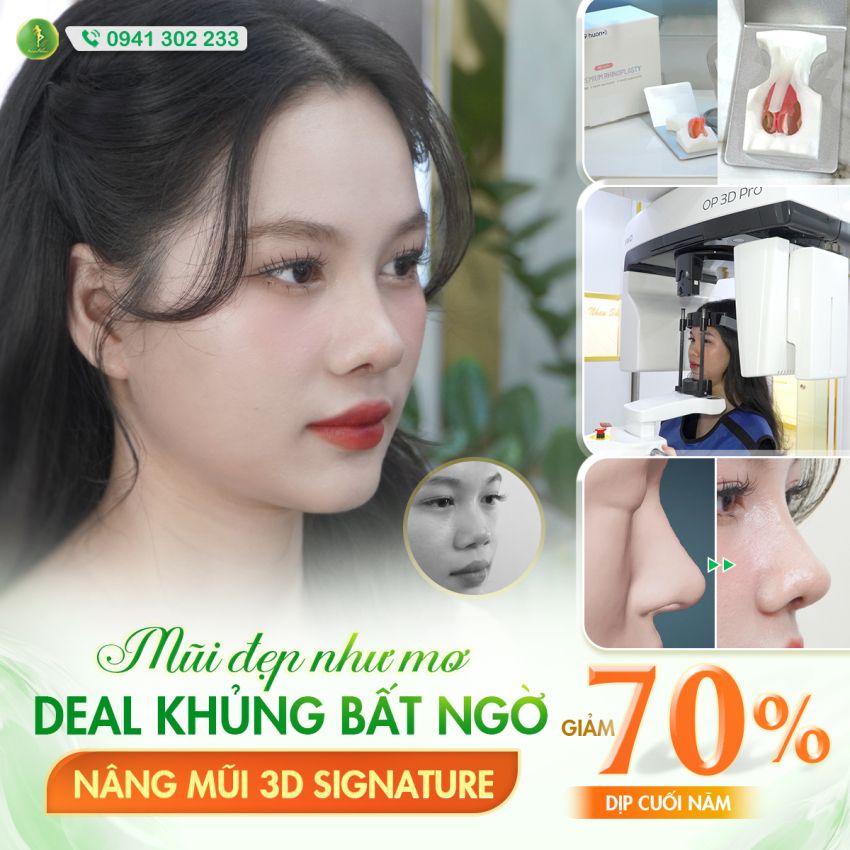 KHÁCH HÀNG TIÊN PHONG TRẢI NGHIỆM PHƯƠNG PHÁP NÂNG MŨI 3D SIGNATURE