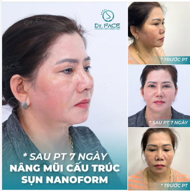 Chỉ cần tâm trí tràn đầy sự tích cực, trái tim phơi phới niềm vui thì lứa tuổi nào cũng là đẹp nhất. Còn về ngoại hình trẻ trung thì càng dễ, để BS lo.