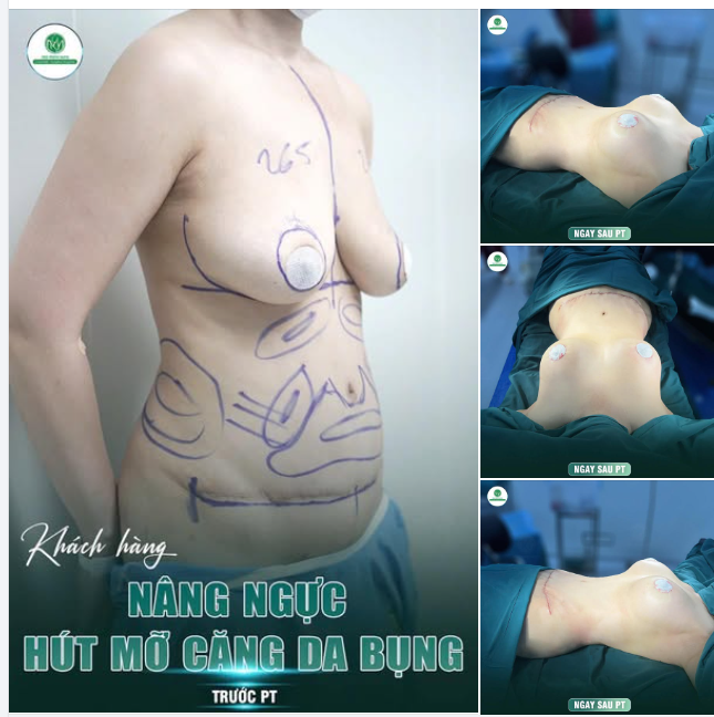 BODY "NÓNG BỎNG" MÓN QUÀ CHO MÙA VALENTINE