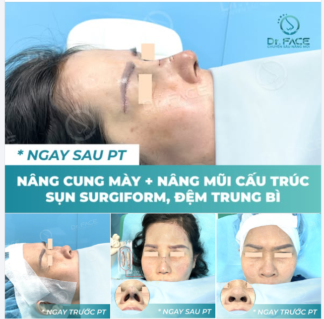 Chắc phải TRẺ RA 10 TUỔI với COMBO này nhỉ?