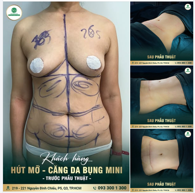 SỰ THAY ĐỔI NÀY CÓ XỨNG ĐÁNG ĐỂ ĐẦU TƯ?