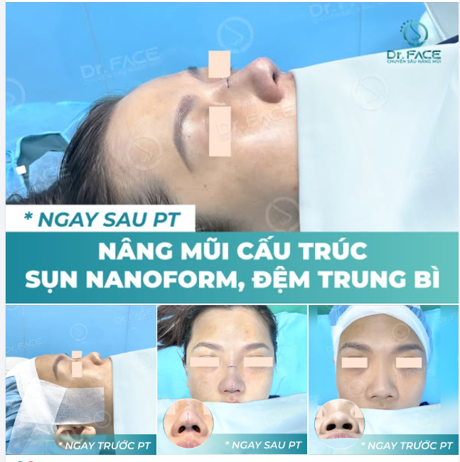 CẦN MỘT NÚT LIKE CHO CA CẤU TRÚC NÀY…