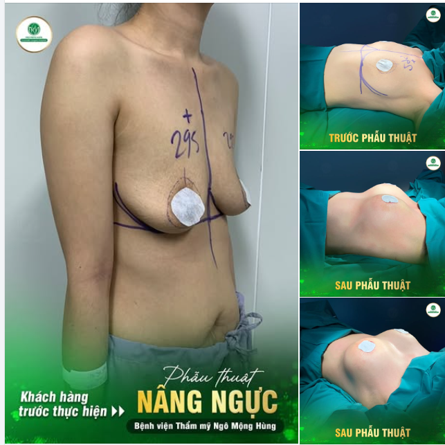 “CỨU NGUY” THÀNH CÔNG VÒNG 1 CHẢY XỆ CHO KH