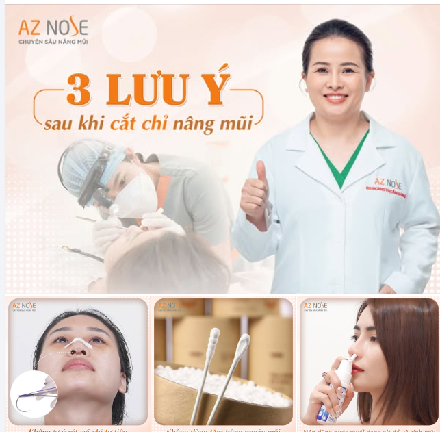 CẦN LƯU Ý GÌ SAU KHI CẮT CHỈ NÂNG MŨI