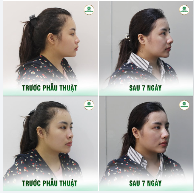 Ở ĐÂY CÓ BÍ QUYẾT GIÚP CHỊ EM “THĂNG HẠNG” NHAN SẮC