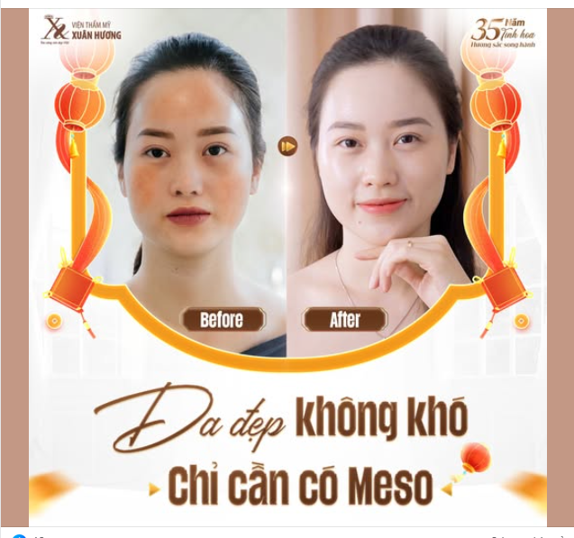 NĂM MỚI - DA CHƯA MỚI? ĐẾN NGAY VIỆN THẨM MỸ XUÂN HƯƠNG!