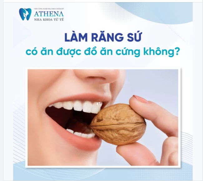 Răng sứ có độ bền cao, giúp ăn nhai tốt hơn, nhưng liệu có thể ăn đồ cứng thoải mái không? Câu trả lời là CÓ nhưng cần lưu ý!