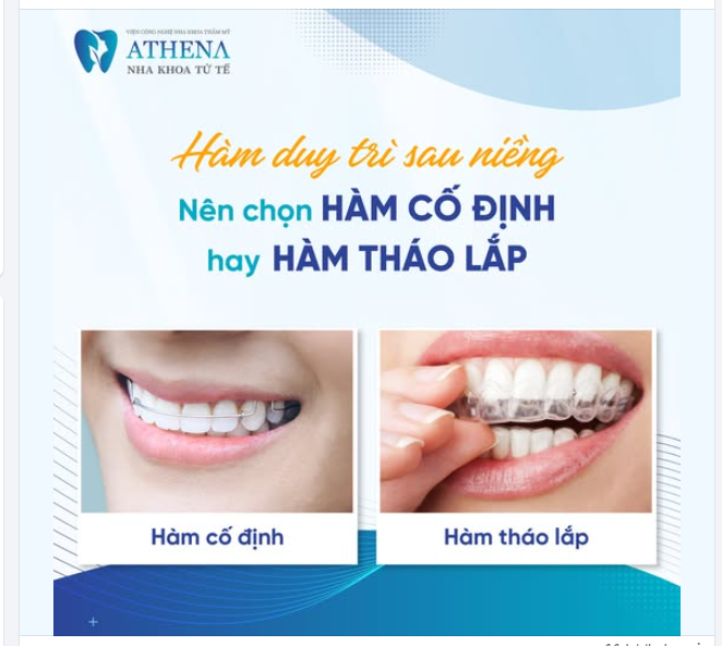 Sau khi tháo niềng, răng vẫn có xu hướng dịch chuyển, vì vậy hàm duy trì là bắt buộc để giữ kết quả ổn định. Nhưng nên chọn loại hàm nào?