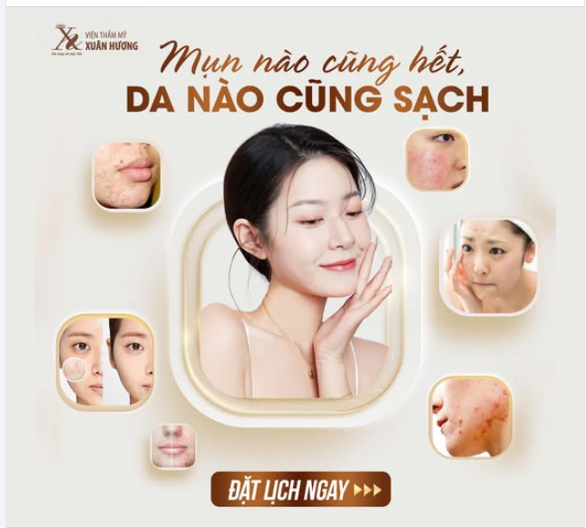 Ăn quá nhiều bánh chưng ngày Tết khiến mụn mọc vô tội vạ?