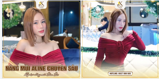 NÂNG MŨI ALINE CHUYÊN SÂU – TẠO DÁNG MŨI HOÀN HẢO