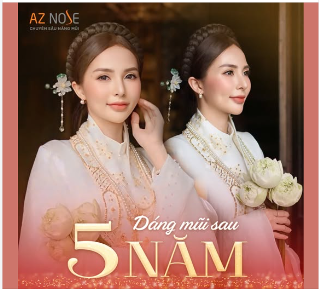 Trộm vía dáng mũi 5 năm vẫn đẹp, vẫn sang, vẫn tự tin toả sáng