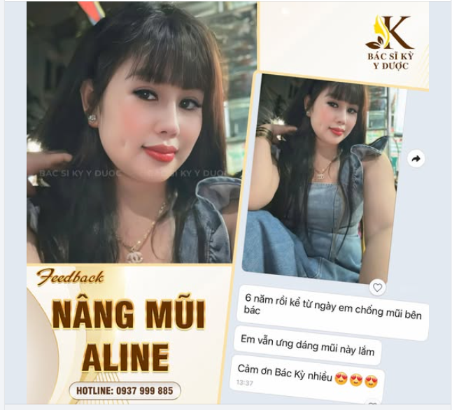 CHUYÊN MỤC FEEDBACK MŨI XINH - 6 NĂM VẪN YÊU DÁNG MŨI NÀY!