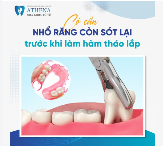 CÓ CẦN NHỔ RĂNG CÒN SÓT LẠI TRƯỚC KHI LÀM HÀM THÁO LẮP KHÔNG?