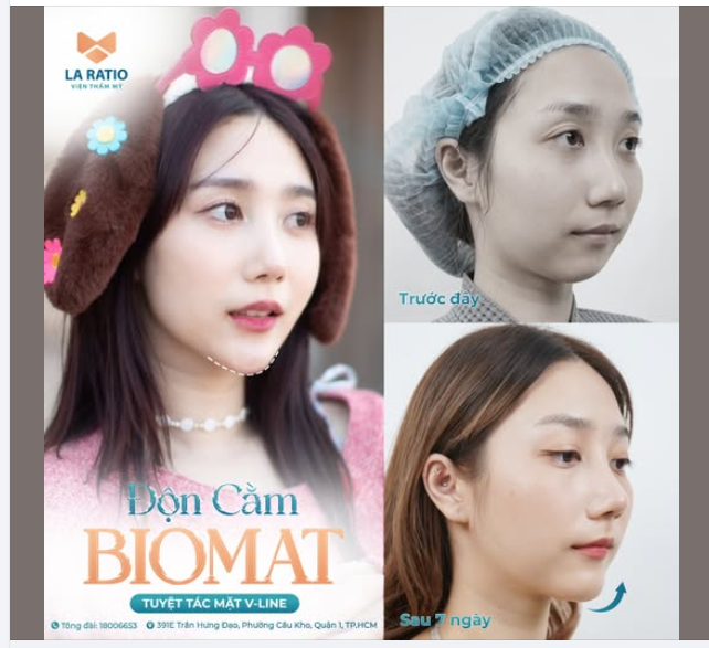 ĐỘN CẰM BIOMAT - TUYỆT TÁC MẶT V-LINE