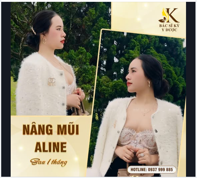 DÁNG MŨI XINH – TỰ TIN XINH ĐẸP