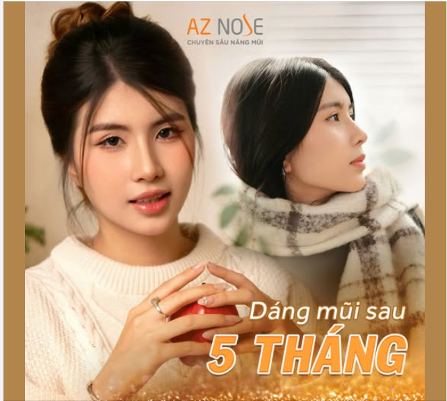 Nhan sắc trong veo của nàng Gen Z sau 5 tháng nâng mũi!