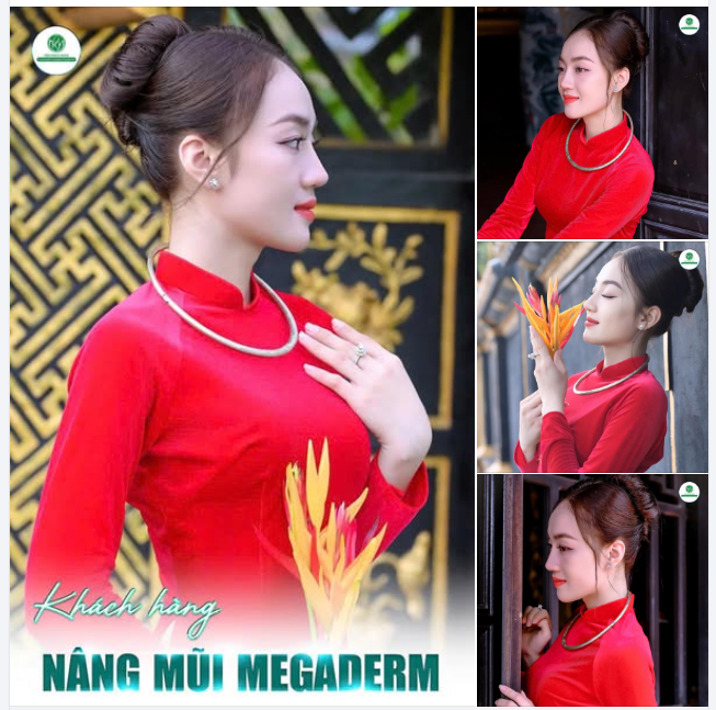 NHAN SẮC NHẸ NHÀNG CÙNG DÁNG MŨI XINH