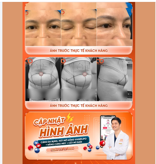 Một ca siêu combo từ trong ra ngoài, sử dụng dao Plasma