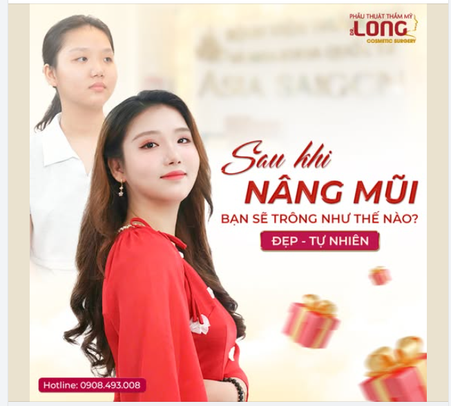 SAU KHI NÂNG MŨI, BẠN SẼ TRÔNG NHƯ THẾ NÀO?