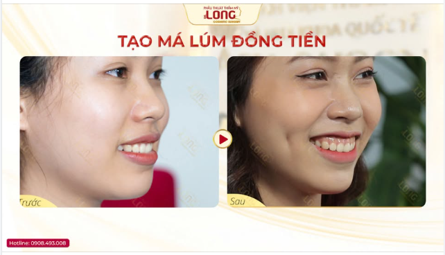 KHUÔN MẶT CỦA BẠN ĐANG THIẾU MỘT ĐIỂM NHẤN?
